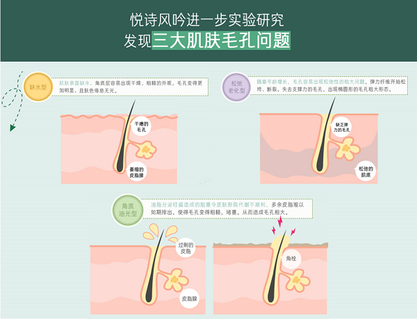 悦诗风吟为中国消费者"量"肤定制全新毛孔细致精华系列